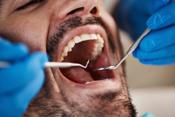 Best Mobile Emergency Dentist in Sparks, GA